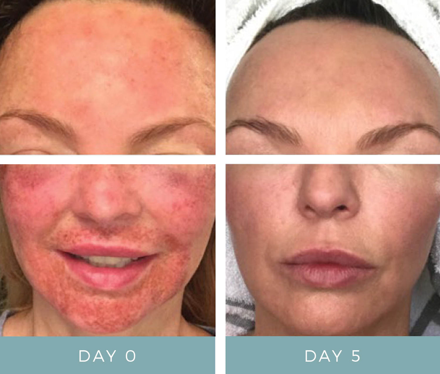 NeoGenesis Recovery Serum
