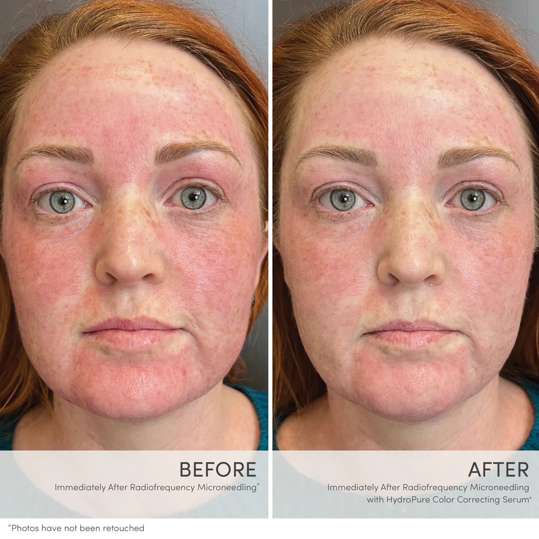 Jane Iredale HydroPure Color Correcting Serum