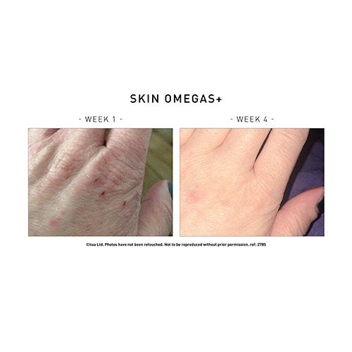 Skin Omegas+