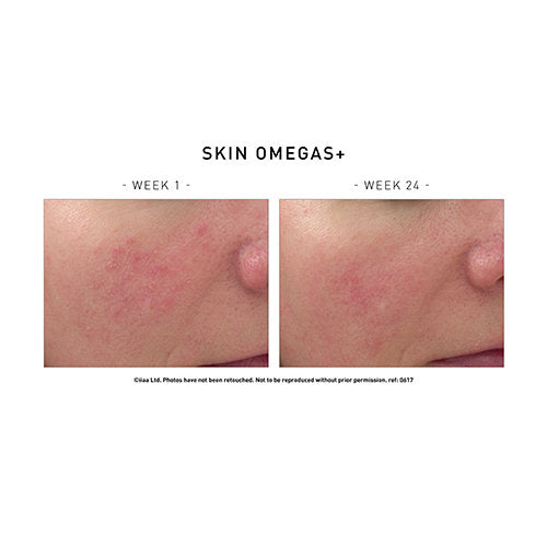 Skin Omegas+